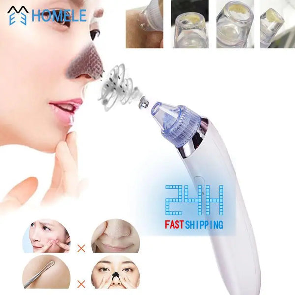 Beauty Tool Visible Results Easy To Use High-quality Best-selling Revolutionary Top-rated Get Rid Of Blackheads Instantly